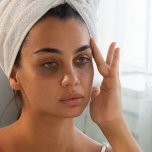 How to Remove Dark Circles Using Home Remedies How to Remove Dark Circles