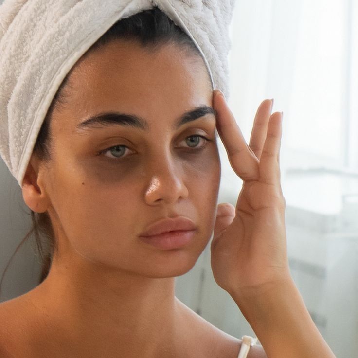 How to Remove Dark Circles